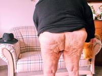 Morbidly obese old woman steps out onto a patio while totally naked - Photo #5