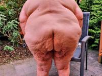 Morbidly obese old woman steps out onto a patio while totally naked - Photo #15