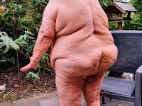 Morbidly obese old woman steps out onto a patio while totally naked - Photo #16