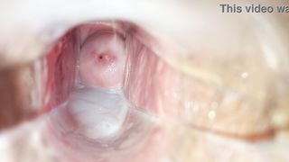 Cum inside pussy close-up speculum
